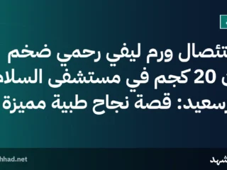 استئصال ورم ليفي رحمي ضخم يزن 20 كجم في مستشفى السلام بورسعيد: قصة نجاح طبية مميزة